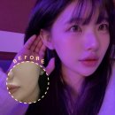 오랜만에 | 내돈내산 대구슈링크 유니버스 600샷 오랜만에 하고 온 만족 후기