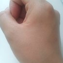 비타릴리스 이미지