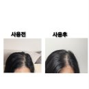 샴퓨 | 려 루트젠 /탈모샴퓨/두피케어/볼륨샴퓨 리뷰입니다 🌿
