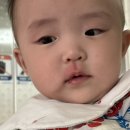 대우병원 | 7개월아기 계란알레르기 거제대우병원응급실 다녀온 후기