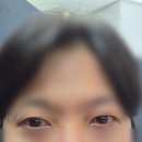 스마일 | [강남]스마일안과 스마일라식 내돈내산 후기 ✔️