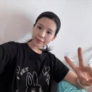 연세모나의원 | 연세모나의원 모발이식 1년차 후기👍🏻😆