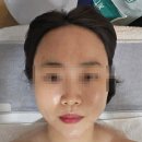 (주)송파오금크린토피아 | 송파피부관리 '뷰리닉스'에서 맞춤관리 솔직후기(스케일링+수분+여드름)