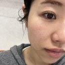 손주약국 | 💉✨너 얼굴에 뭐 했어? - &lt; 쥬베룩 시술 솔직 후기! / 얼굴 경락 / 캐비어 피부관리 &gt;