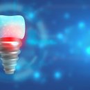 이유 치과기공소 이미지