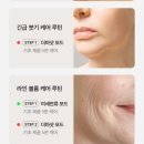메디큐브 부스터프로 에이지알 솔직 한달후기!!