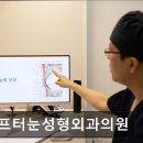 애프터눈성형외과의원 네이버블로그