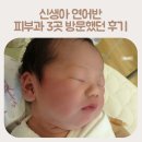 덜미미간 | 신생아연어반 천사의키스 여전히 그대로 없어지는 시기는?