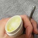 신광미용실 | 성인 아토피 치료과정 (한의원 치료 6개월 후기)