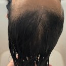 더끌린헤어 | 기흥 동백 미용실 나노힐클리닉 권율원장님 내돈내산후기