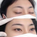 리메이드청주점 | 청주남자눈썹문신 이미지 리셋 성공 후기 리메이드 청주점