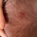 오즈피부과의원 이미지