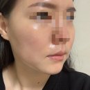 인셀덤 은평대리점 이미지