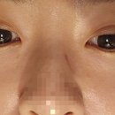3층안경 | 브리즘 안경 내돈내산 방문후기, 변색렌즈가격, 민생지원금 사용가능매장