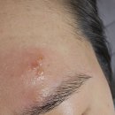 국홍일국정표피부과의원 이미지