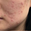 신정약초 이미지