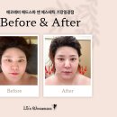 해송1로 | 기장헤드스파 에코레비 헤드스파 앤 에스테틱 | 머메이드 윤곽관리로 림프순환부터 턱선까지 살린 후기