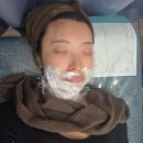 창원1 | 창원 편평사마귀 제거 <내돈내산> 후기 1일차