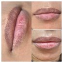 오렌지라인 | 어두운 입술라인 코랄오렌지로 바뀐 리얼후기