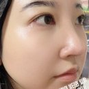 청담바른약국 | [피부 재생크림] 청담 클리닉에서 시작된 피쓰(Pith) 코어 리빌드 크림 회복크림 일주일 찐 사용 후기