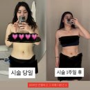 늘편한한의원 | [내돈내산] 강남한의원다이어트 과연 살이 빠질까...1시간 체지방 감량 솔직후기 (feat. 강남역...