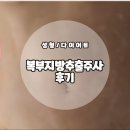루다펫 | [다이어트 성형 지방추출주사]연세루다의원 '루다펫' 복부지방 흡입 1~2주 후기