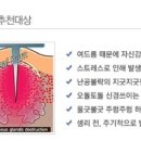 에스피부과의원 이미지