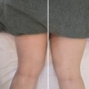 더 예뻐 / 청주 비하동 에스테틱 하체관리 받고 온 후기 / 비하동에스테틱 추천 / 가경동 신부관리 추천