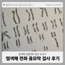 전좌로 | [염색체 전좌 임신 도전기 5탄] 서초함춘 융모막검사 후기