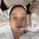 대흥약품 | 대흥역 피부관리 벨리뷰티셀플라 스킨스케일링 후기 및 주차정보
