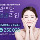 이오V