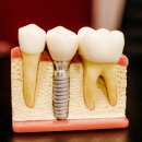 밝은e치과의원 이미지