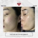 더제이메디칼 네이버블로그