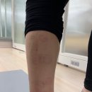 운동재활트레이닝 이미지