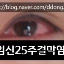 난초꽃피다임앤오안과