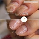 라온네일클리닉안양