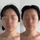 경원로55번길 | 김해 윤곽관리, 바름바디케어 에스테틱 리얼 후기