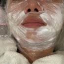 창원 | 창원피부과 슈링크 400샷 솔직후기 창원 슈링크 잘하는곳