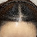 바람부는날에도 성형외과의원 이미지