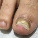 매료네일 문제성전문점 이미지