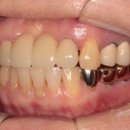 연세좋은치과기공소 이미지