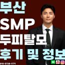 원스칼프 | 부산두피문신 잘하는곳 찾는다면? 자연스러운 SMP 후기