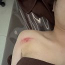 비채1 | 수성구 바디관리 전문 비채에스테틱 범물점 등 온열 테라피 후기