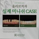 올리브치과의원 이미지