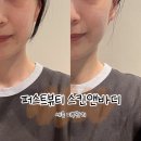 정;뷰티스킨앤바디 | 세종 피부관리 추천 퍼스트뷰티 스킨앤바디 (나성동 에스테틱 톤업 미백관리 후기, 주차, 예약)