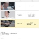 푸른길정형외과의원 네이버블로그