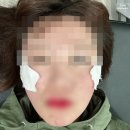 민영의원 | 송파 흑자 제거 리팟레이저 후기 루미의원