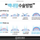 글로리서울안과의원 이미지