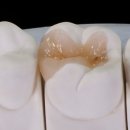 본 치과기공소 이미지