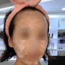 러블리 인셀덤 | 인셀덤수원 피부관리 후기 인셀덤러블리웨라